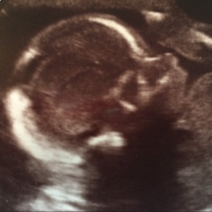 Babynieuws binnen de praktijk!