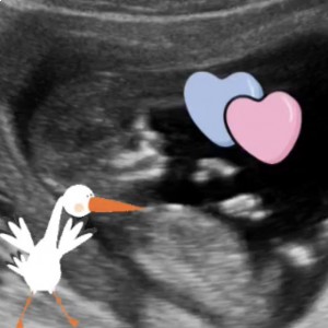 Babynieuws in de praktijk!